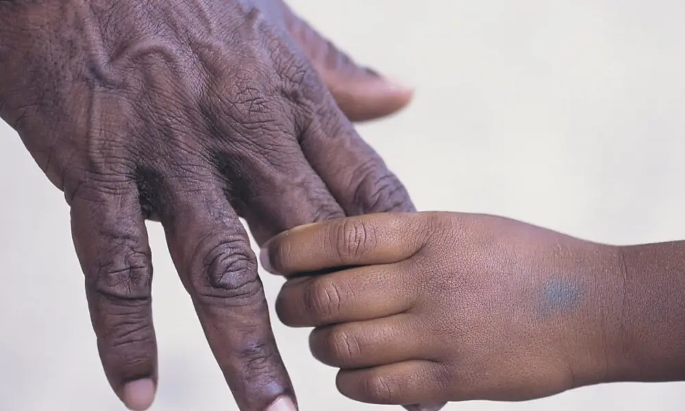 Jornal Contábil | Nova lei do INSS passa a valer e amplia direito a pensão por morte – Jornal Contábil