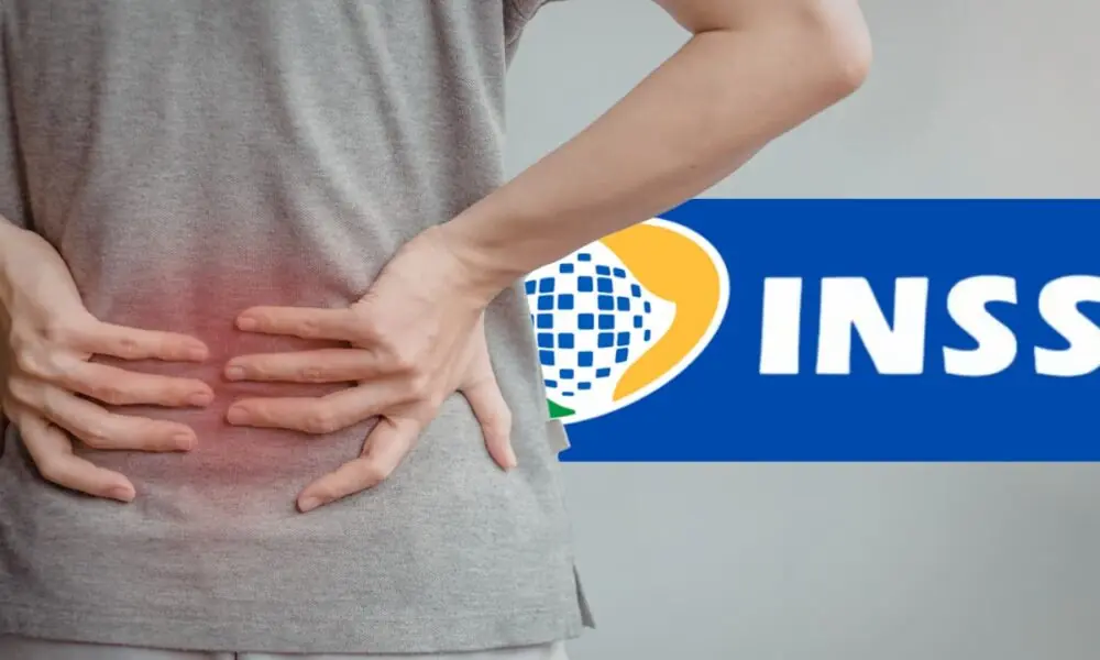 Jornal Contábil | Entenda como encostar pelo INSS em 2026 por problema de coluna – Jornal Contábil